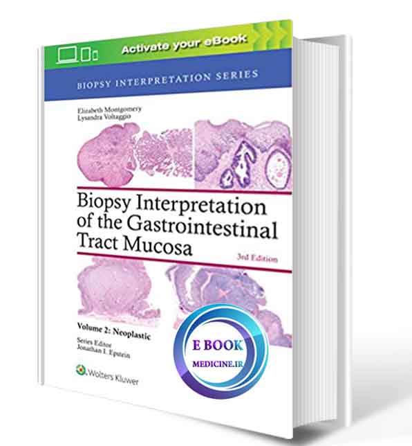 دانلود کتابBiopsy Interpretation of the Gastrointestinal Tract Mucosa: Volume 2: Neoplastic2017(epub)